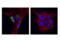 Matrix Metallopeptidase 2 antibody, 40994S, Cell Signaling Technology, Immunofluorescence image 