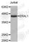 Era Like 12S Mitochondrial RRNA Chaperone 1 antibody, A5974, ABclonal Technology, Western Blot image 
