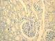 CD1a Molecule antibody, ab108309, Abcam, Immunohistochemistry paraffin image 