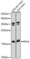 Replication Protein A3 antibody, A6721, ABclonal Technology, Western Blot image 