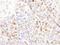 Deoxycytidine Kinase antibody, A304-266A, Bethyl Labs, Immunohistochemistry frozen image 