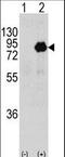 Phosphoinositide-3-Kinase Regulatory Subunit 2 antibody, LS-C101101, Lifespan Biosciences, Western Blot image 