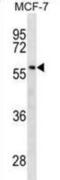 Glucosylceramidase Beta antibody, abx025534, Abbexa, Western Blot image 