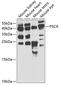 Prostate Stem Cell Antigen antibody, 19-756, ProSci, Western Blot image 