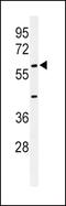 Anti-Mullerian Hormone antibody, PA5-26938, Invitrogen Antibodies, Western Blot image 