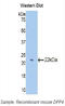 Dipeptidyl Peptidase 4 antibody, LS-C293701, Lifespan Biosciences, Western Blot image 