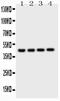 Cathepsin D antibody, PA5-79094, Invitrogen Antibodies, Western Blot image 