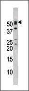 Nucleoporin 50 antibody, 60-337, ProSci, Western Blot image 