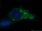 Myosin Light Chain 2 antibody, 60229-1-Ig, Proteintech Group, Immunofluorescence image 
