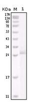 ERBB2 antibody, AM06167SU-N, Origene, Western Blot image 