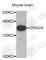 Glutamate Ionotropic Receptor NMDA Type Subunit 2A antibody, A3603, ABclonal Technology, Western Blot image 