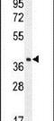 Tetraspan membrane protein of hair cell stereocilia antibody, PA5-23919, Invitrogen Antibodies, Western Blot image 