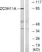 Zinc Finger CCCH-Type Containing 11A antibody, LS-C120472, Lifespan Biosciences, Western Blot image 