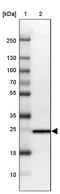 TPD52 Like 1 antibody, PA5-55730, Invitrogen Antibodies, Western Blot image 