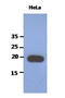 Poly(A) Binding Protein Interacting Protein 2 antibody, MBS200235, MyBioSource, Western Blot image 