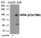 Erb-B2 Receptor Tyrosine Kinase 4 antibody, GTX55426, GeneTex, Western Blot image 