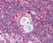 Autoimmune Regulator antibody, PA5-18067, Invitrogen Antibodies, Immunohistochemistry paraffin image 