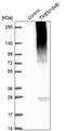 Transmembrane Protein 184B antibody, PA5-54973, Invitrogen Antibodies, Western Blot image 