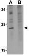 Tetraspanin 9 antibody, GTX85211, GeneTex, Western Blot image 