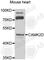 Calcium/Calmodulin Dependent Protein Kinase II Delta antibody, A7323, ABclonal Technology, Western Blot image 