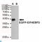 Eukaryotic Translation Initiation Factor 4E Binding Protein 3 antibody, LS-C813217, Lifespan Biosciences, Western Blot image 