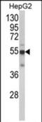 Cytochrome P450 2J2 antibody, PA5-72516, Invitrogen Antibodies, Western Blot image 