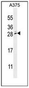 Methyl-CpG Binding Domain Protein 3 Like 2 antibody, AP52619PU-N, Origene, Western Blot image 