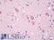 Huntingtin antibody, LS-B8023, Lifespan Biosciences, Immunohistochemistry paraffin image 