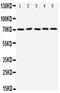 PD-L1 antibody, PA5-78972, Invitrogen Antibodies, Western Blot image 