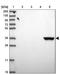 Aldo-Keto Reductase Family 1 Member C4 antibody, NBP2-14277, Novus Biologicals, Western Blot image 