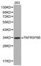 Tumor necrosis factor receptor superfamily member 6B antibody, LS-C192423, Lifespan Biosciences, Western Blot image 