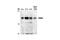 Histone Deacetylase 4 antibody, 2072S, Cell Signaling Technology, Western Blot image 
