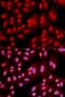 Protein Phosphatase 2 Regulatory Subunit Balpha antibody, LS-C335210, Lifespan Biosciences, Immunofluorescence image 