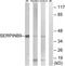 Serpin Family B Member 9 antibody, TA312970, Origene, Western Blot image 