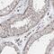 Transmembrane And Coiled-Coil Domains 6 antibody, NBP1-83463, Novus Biologicals, Immunohistochemistry paraffin image 