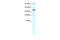 RNA Polymerase II Subunit B antibody, 27-602, ProSci, Western Blot image 