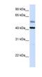 Armadillo Repeat Containing X-Linked 1 antibody, NBP1-59412, Novus Biologicals, Western Blot image 