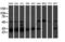Proteasome Subunit Beta 7 antibody, M08095, Boster Biological Technology, Western Blot image 
