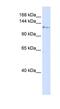 Kinesin Family Member 5C antibody, NBP1-56525, Novus Biologicals, Western Blot image 