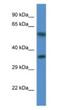 Mitochondrial Ribosomal Protein L45 antibody, NBP1-74261, Novus Biologicals, Western Blot image 