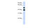 Ubiquitin Specific Peptidase 22 antibody, 27-157, ProSci, Enzyme Linked Immunosorbent Assay image 