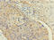 Calmodulin Like 3 antibody, LS-C675456, Lifespan Biosciences, Immunohistochemistry paraffin image 