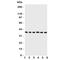 Cyclin Dependent Kinase 7 antibody, R31241, NSJ Bioreagents, Western Blot image 
