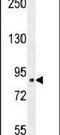 Chloride Intracellular Channel 6 antibody, PA5-23976, Invitrogen Antibodies, Western Blot image 