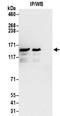 Solute Carrier Family 16 Member 2 antibody, NBP2-32109, Novus Biologicals, Immunoprecipitation image 
