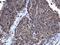 Cyclin Dependent Kinase 1 antibody, GTX108120, GeneTex, Immunohistochemistry paraffin image 