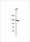 Collagen Type I Alpha 2 Chain antibody, 55-916, ProSci, Western Blot image 