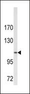 Collagen Type VI Alpha 1 Chain antibody, 62-345, ProSci, Western Blot image 