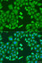 Cytochrome P450 Family 11 Subfamily B Member 1 antibody, 15-847, ProSci, Immunofluorescence image 
