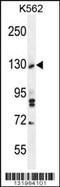 Tau Tubulin Kinase 2 antibody, MBS9206888, MyBioSource, Western Blot image 